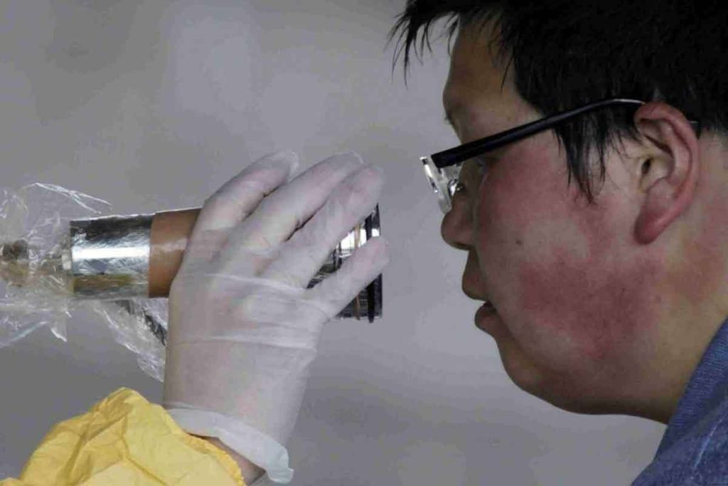 Real Radiation Effects on Human Body: 8 True Cases