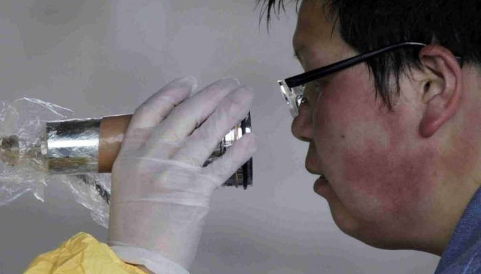 Real Radiation Effects on Human Body: 8 True Cases