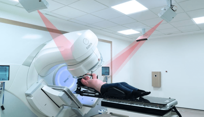 After Effects of Radiotherapy: Know the Risks