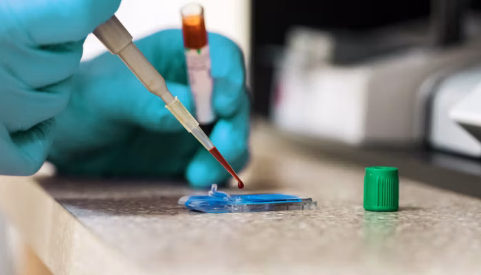 testing-blood-in-lab-1296-728-header